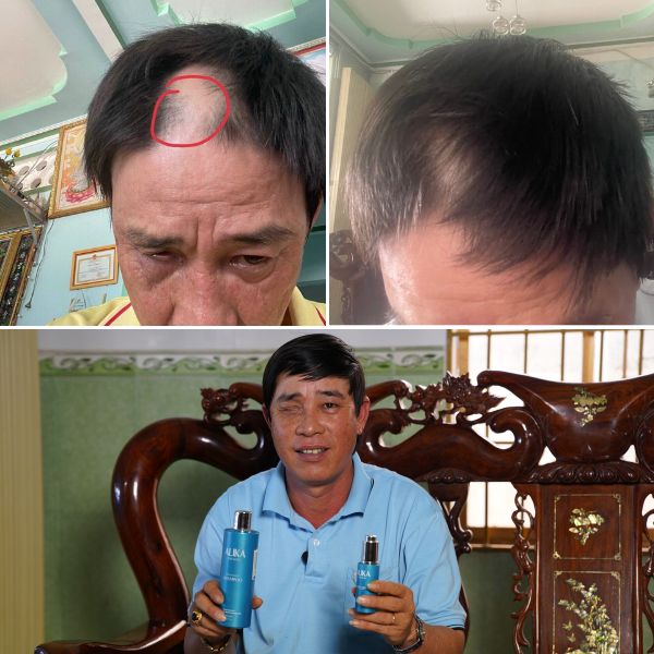 Root Reactivating Hair Serum For Men