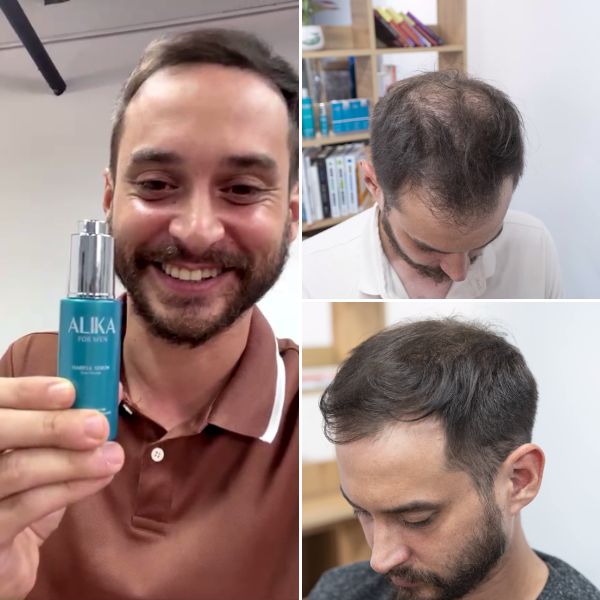 Root Reactivating Hair Serum For Men